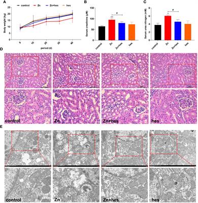 Hesperidin alleviates zinc-induced nephrotoxicity via the gut-kidney axis in swine